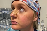 A woman wears a surgical cap and gown and has tape across her nose.