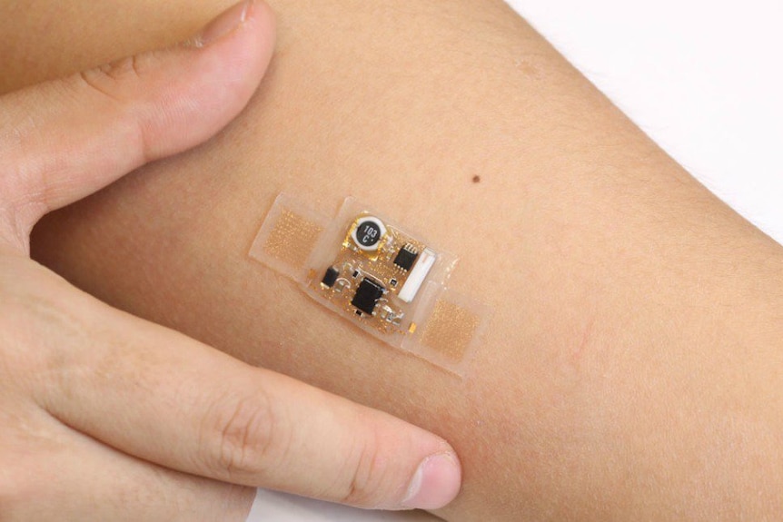 Electronic skin patch on a forearm