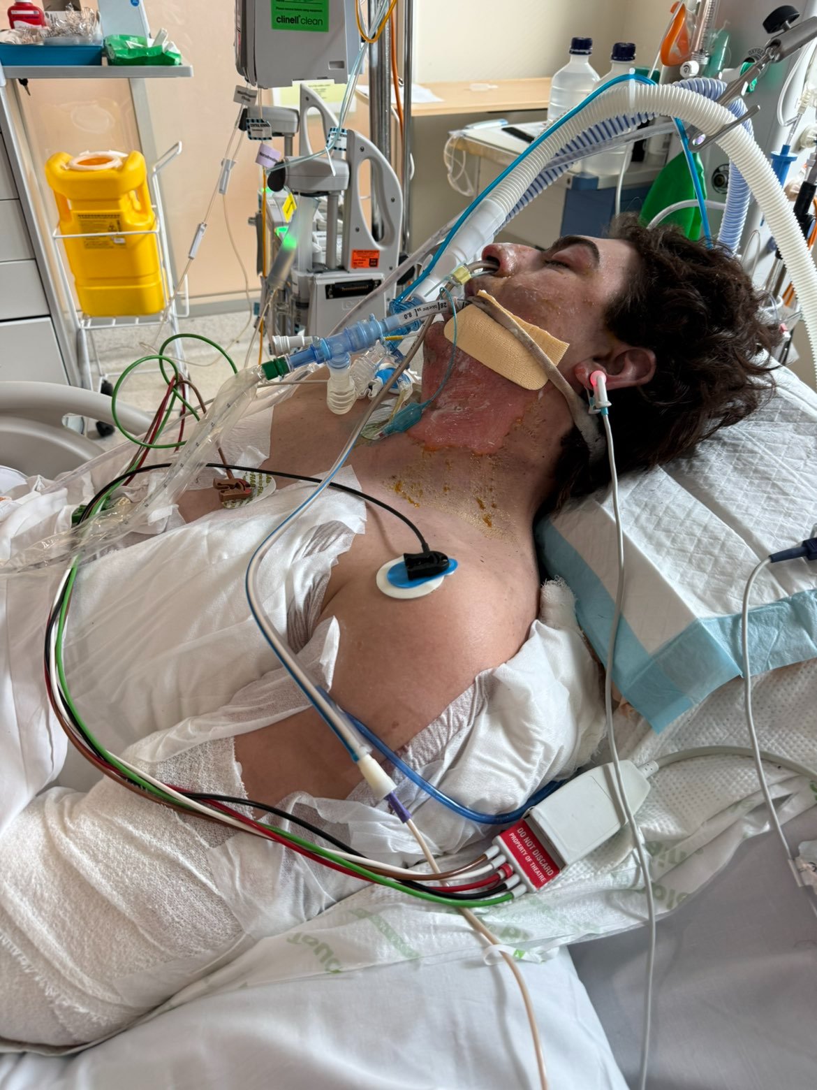 Family 'turned upside down' after man critically injured by robot vacuum