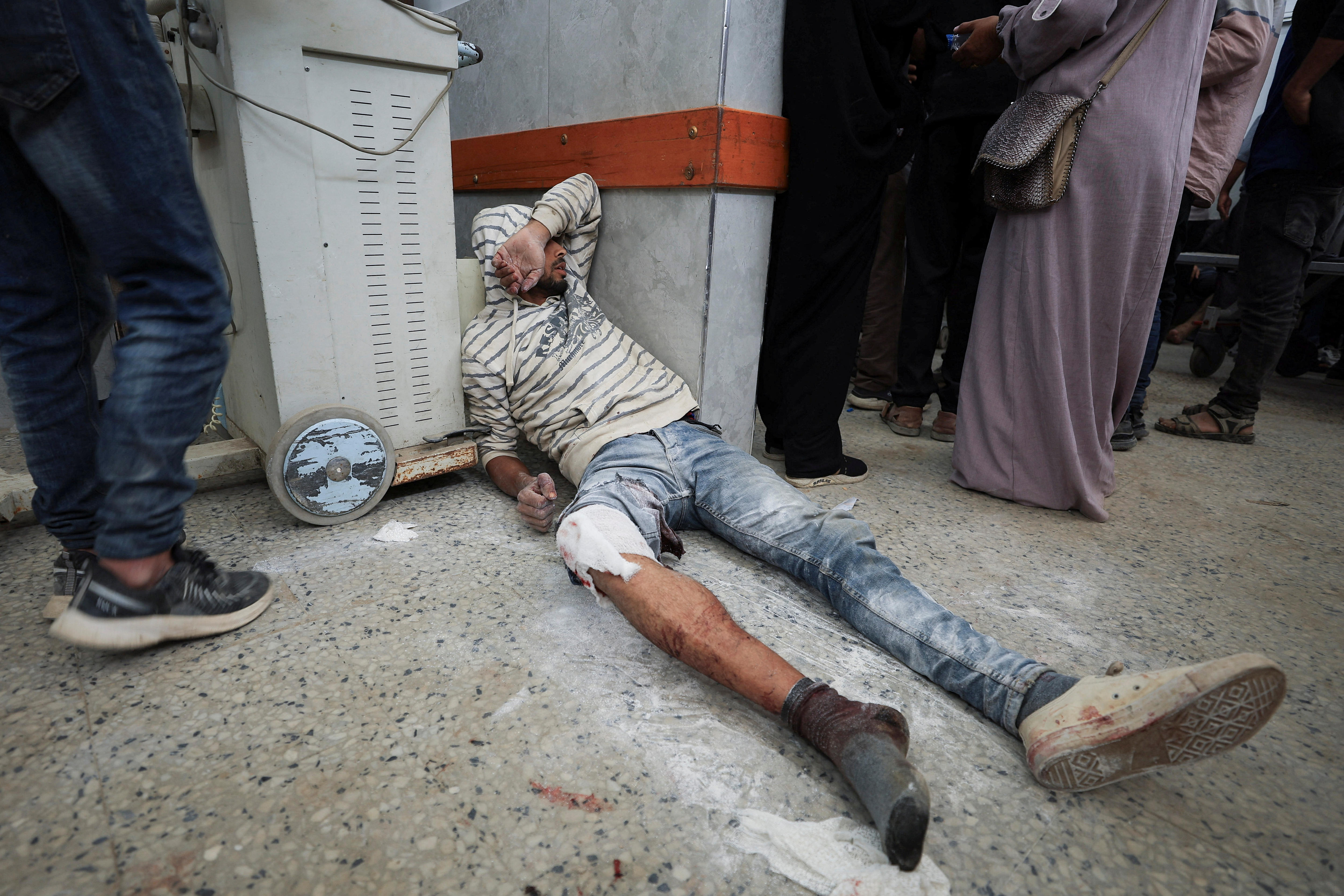 A young man lies on a hospital floor with a bandaged leg.
