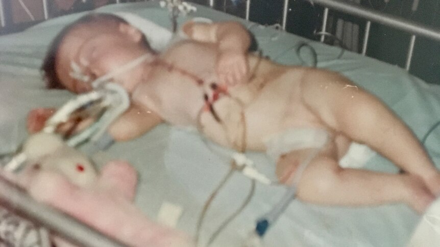 Old photo of baby in intensive care unit