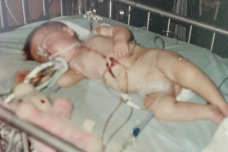 Old photo of baby in intensive care unit