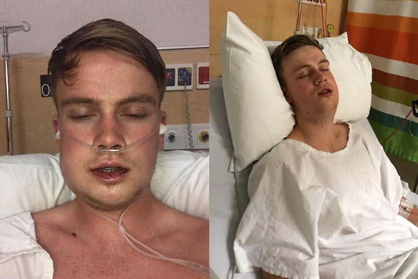 Two photos showing a young man with a swollen and injured jaw in hospital.