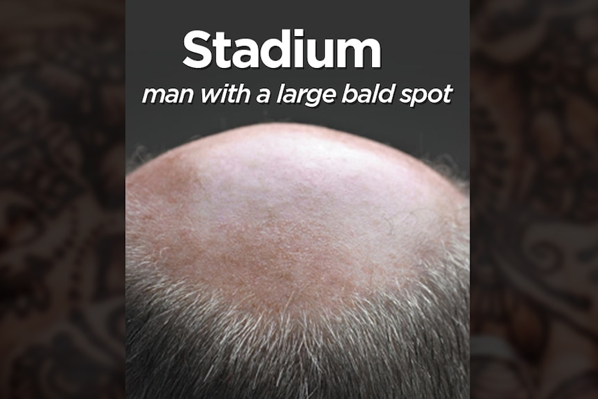 The top of a balding man's head.