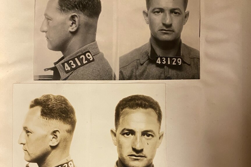 Black and white photo of 'before' and 'after' mugshot of man with crooked and then straightened nose in the second image.
