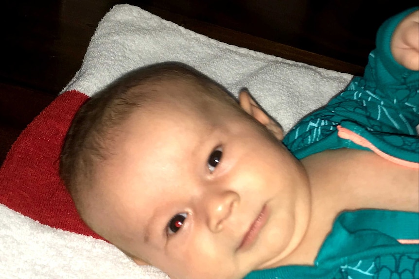 A baby with a red glow in one eye after a flash photograph