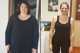 Lauren Rouse before and after her gastric band surgery.