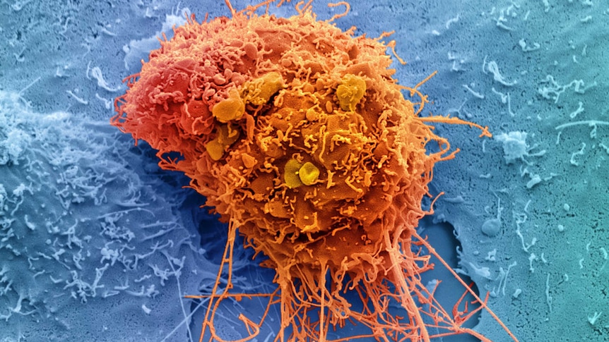 Cervical cancer cell