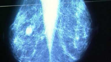 A new report reveals the number of women participating in breast screening continues to rise.