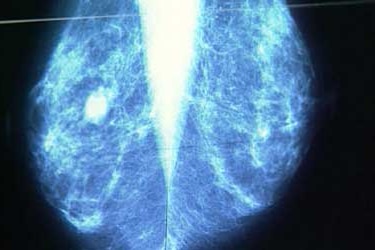 A new report reveals the number of women participating in breast screening continues to rise.