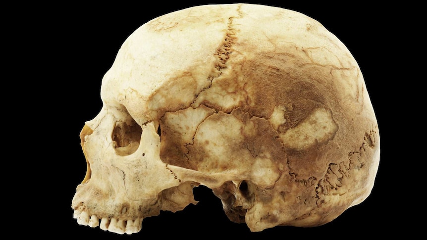 A profile photo of a human skull.