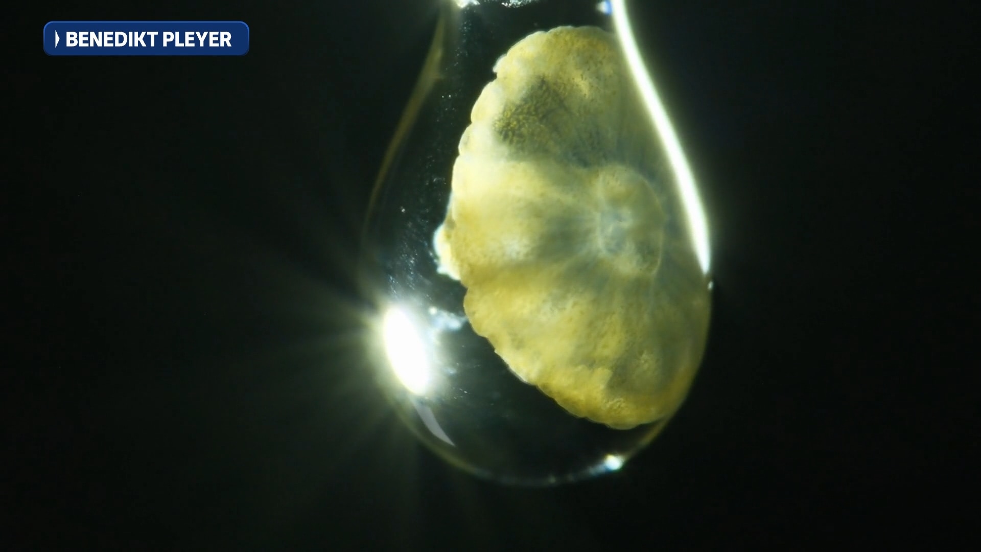 Microscopic image of jellyfish larvae suspended in water droplet.