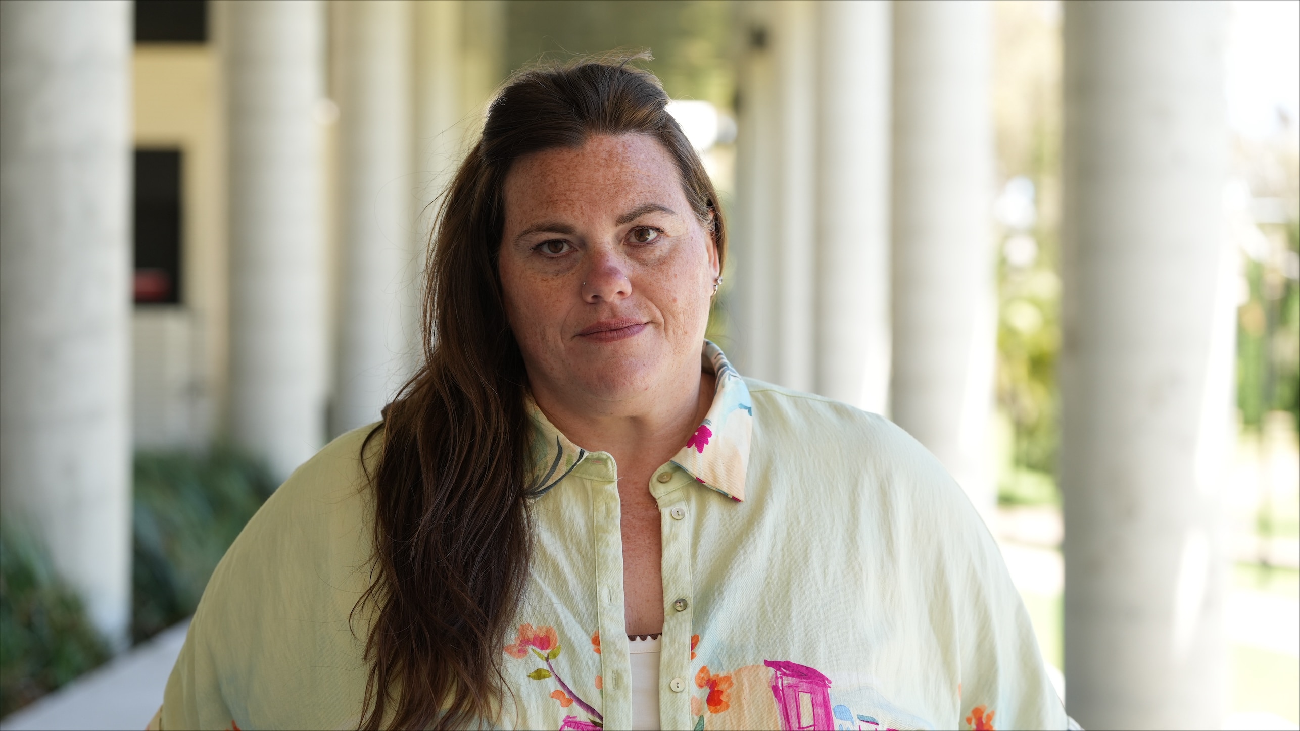 Patients removed from Canberra health waitlists via letter - ABC News & Headlines – Australian Broadcasting Corporation