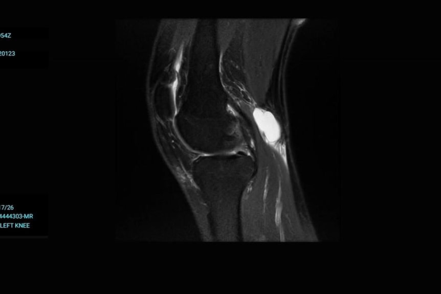 Medical image showing a human knee.
