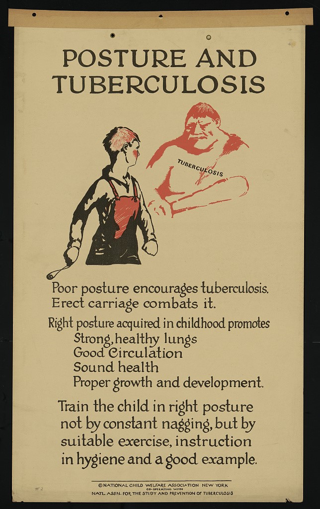 An old poster warning of the link between tuberculosis and poor posture