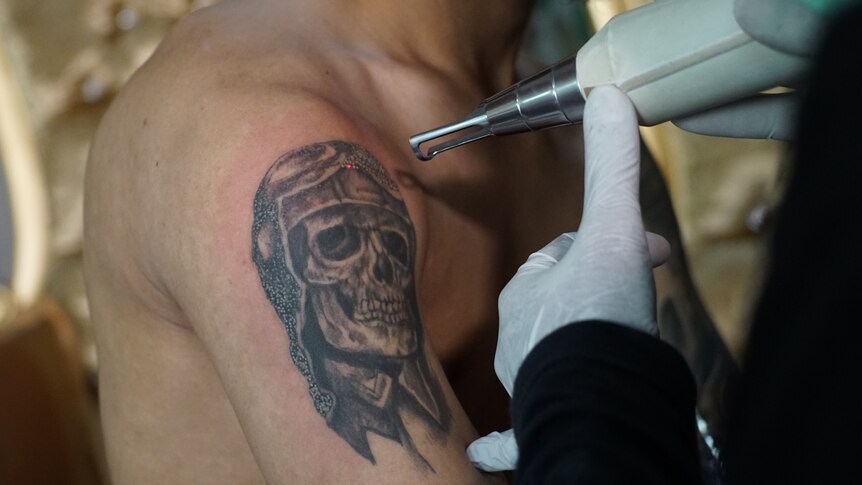 Tattoo removal is painful, but for born-again Indonesian Muslims the process is cleansing.