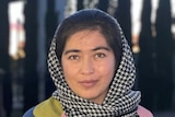 A woman wearing a black and white checkered scarf