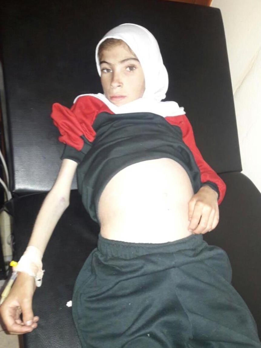 A 12-year-old Syrian girl who died from malnutrition