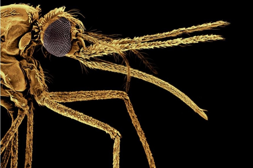 Anopheles mosquito species as seen under scanning electron microscope at 20x magnification