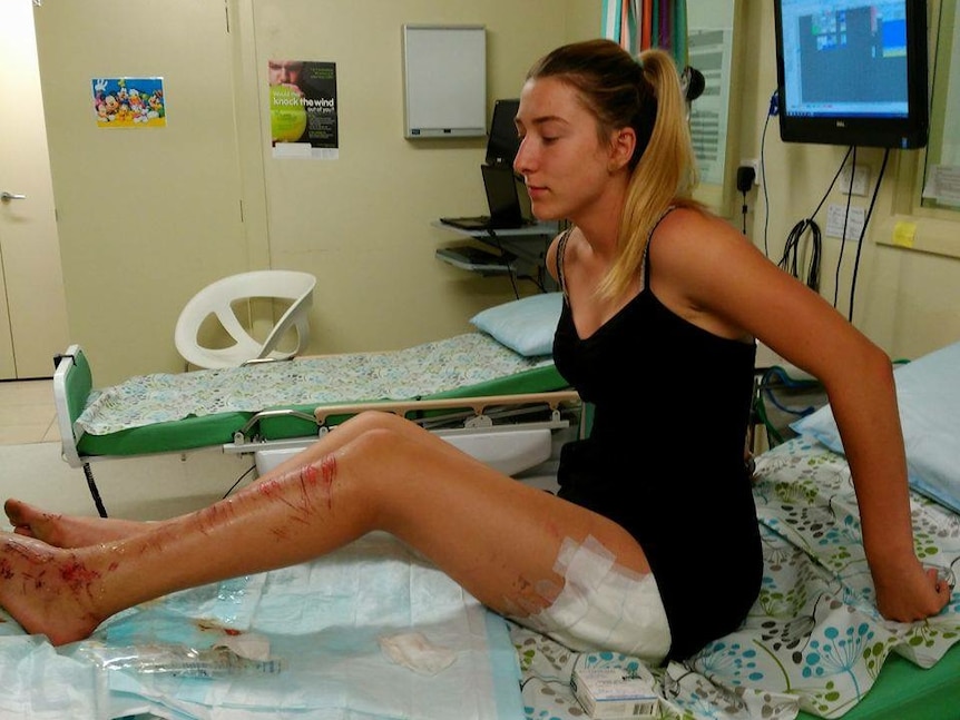 A teenage girl in hospital with scratches on her legs and hands.