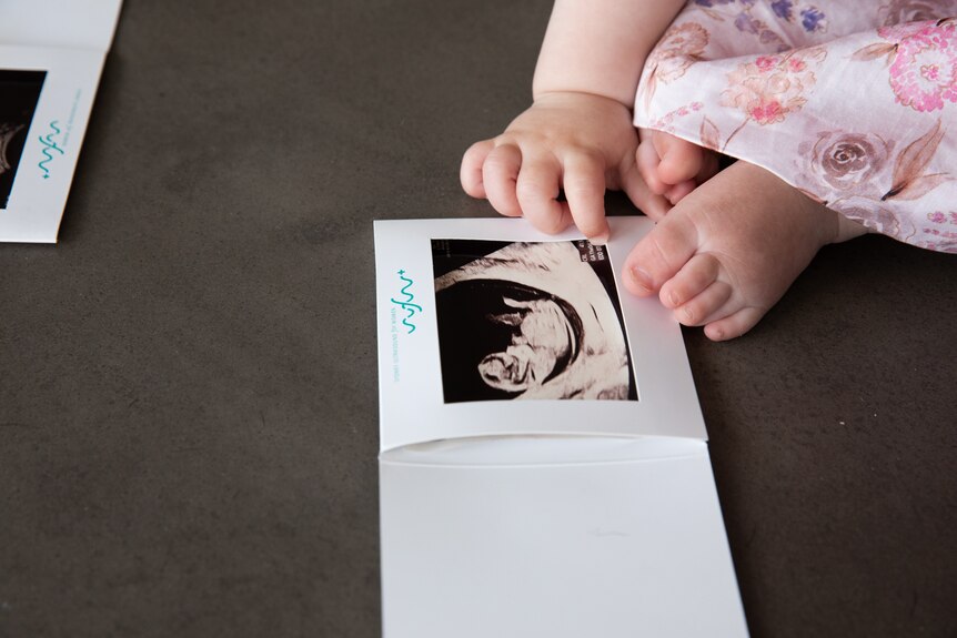 A young child holds an ultrasound image of herself.