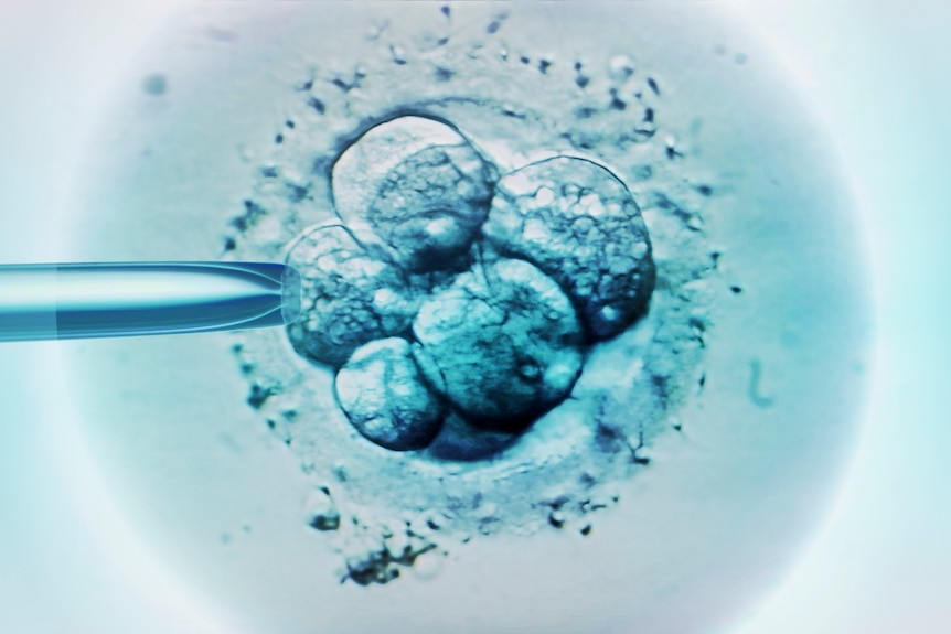 Light micrograph of embryonic cells