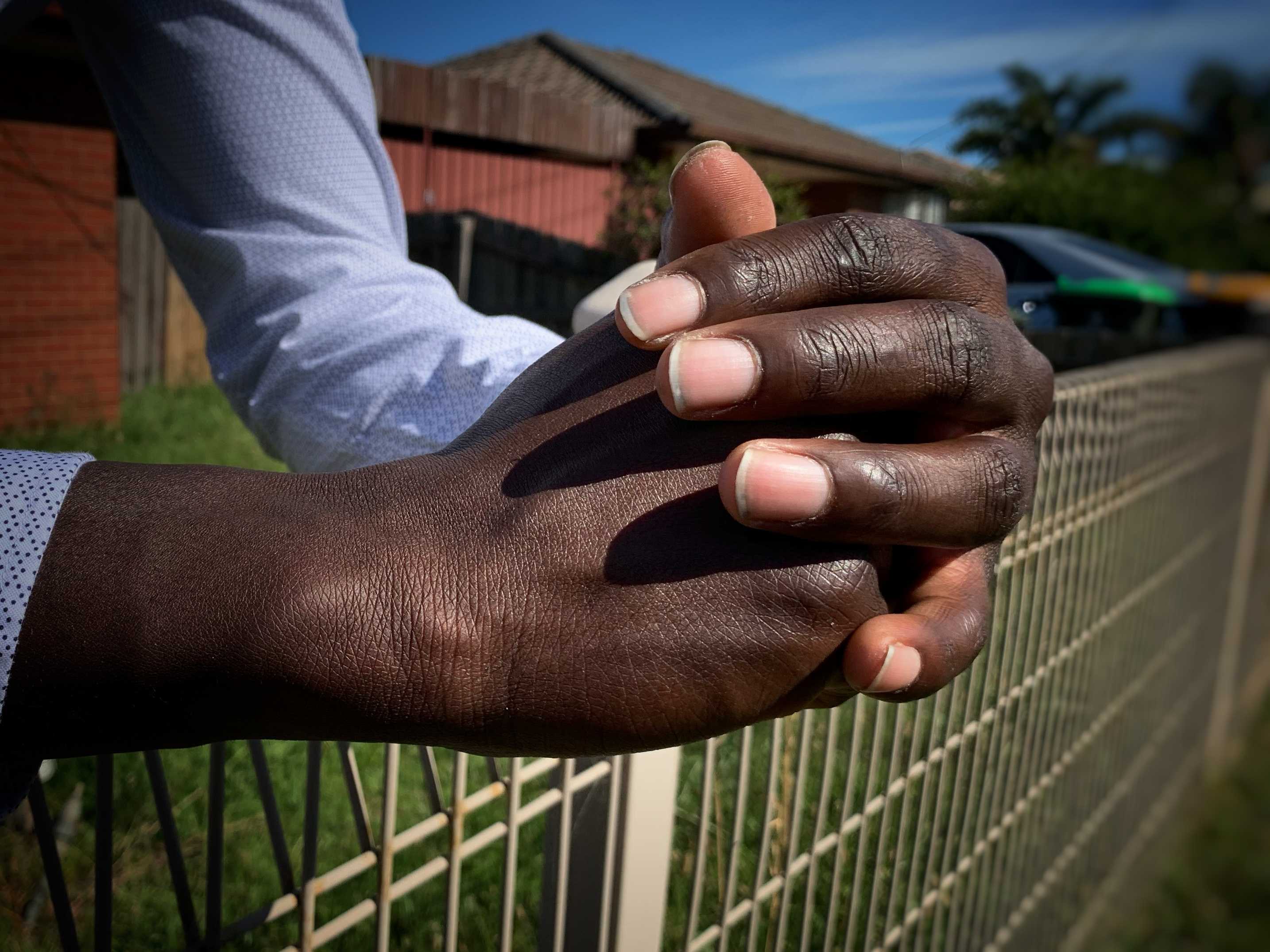 A pair of hands clasped together rest on a fence.