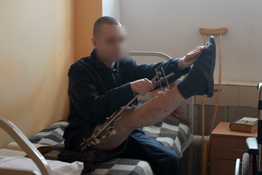 A young man with a shaved head holds up his leg which is in a wire brace.