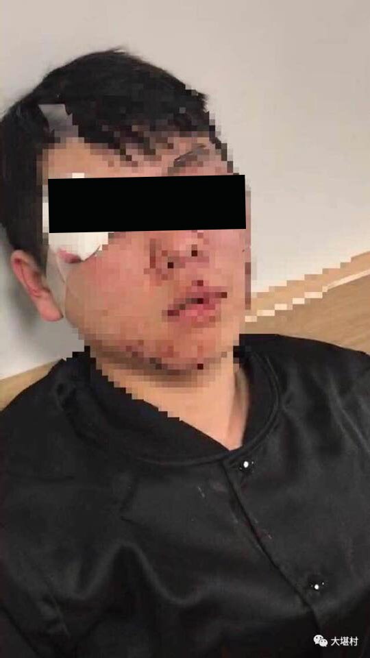 Chinese high school students allegedly bashed by youths at Canberra bus ...