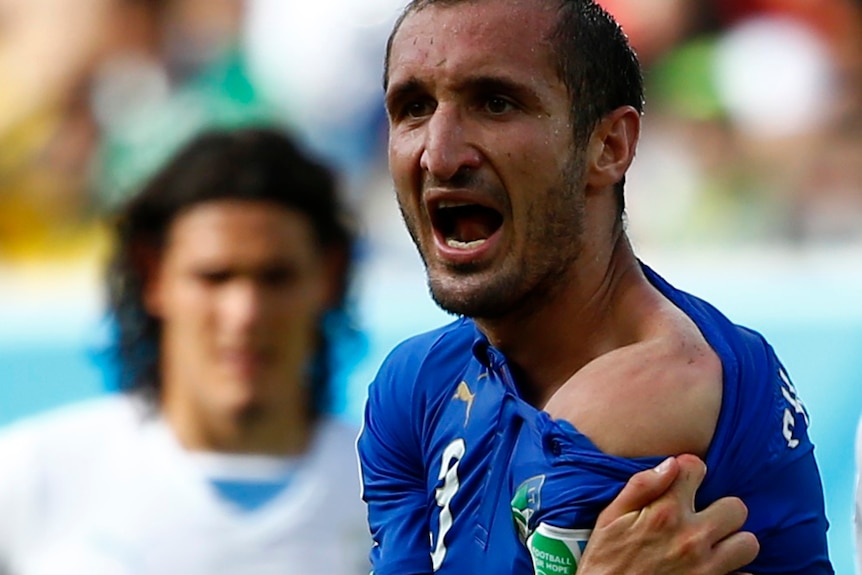 Chiellini shows off Suarez bite marks