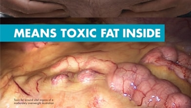 LiveLighter's toxic fat ad
