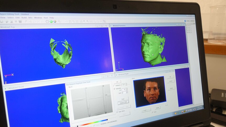 Screen showing scans of reporter Jake Sturmer's head