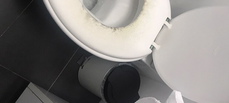 A toilet seat with mould around the rim.