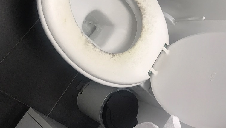 A toilet seat with mould around the rim.