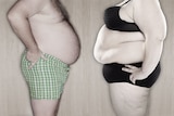 Is obesity a disease?