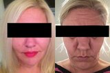before and after of a woman's face with eyes blacked out.