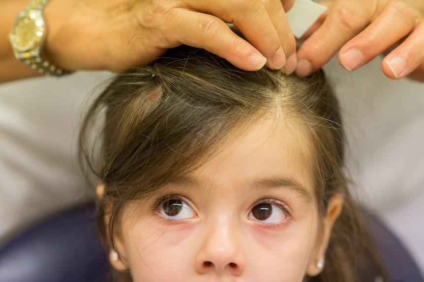 Melina Movsisian has electrodes stuck to her scalp