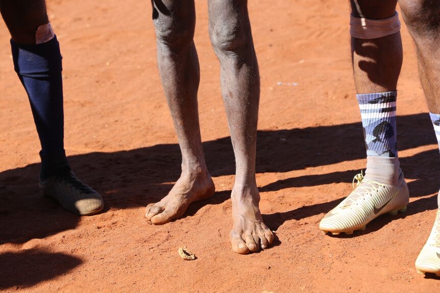 A barefoot player stands between two others who are wearing football boots.