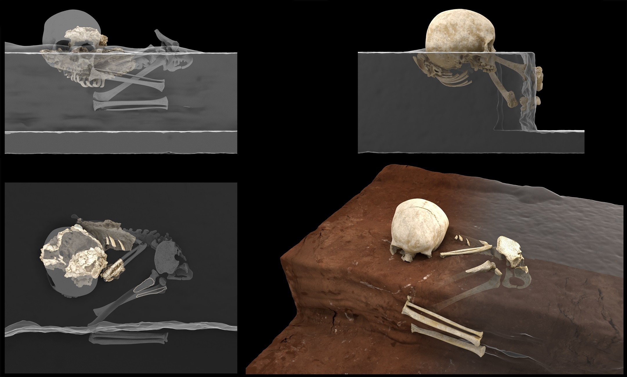 Digital images of a child's skeleton