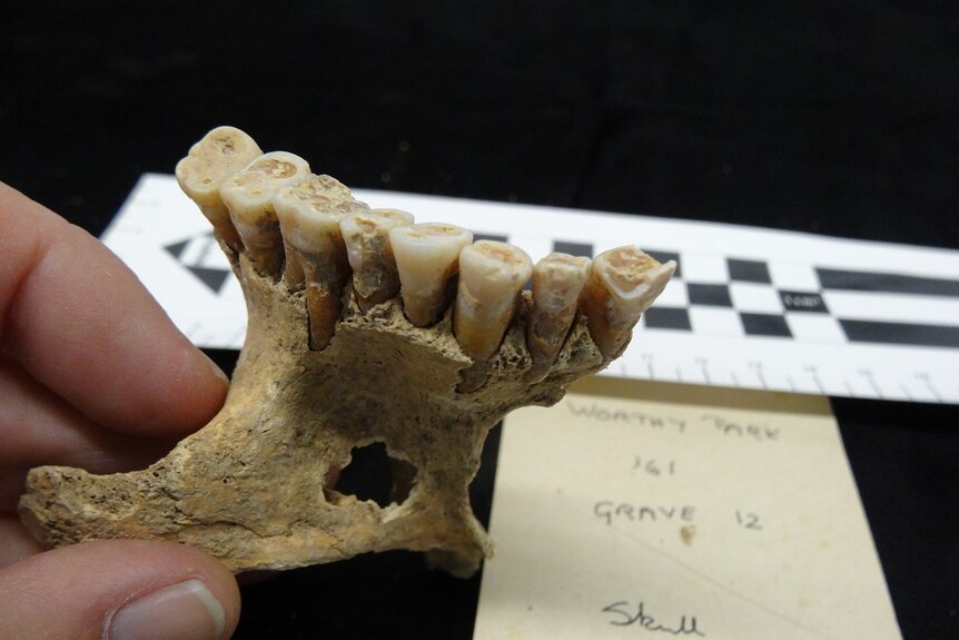A fragment of human jawbone with teeth visible.