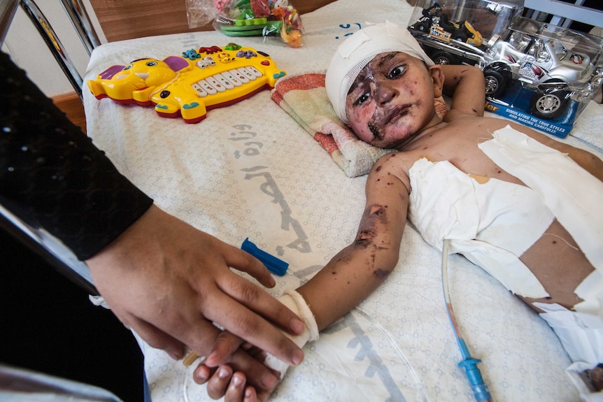 Young child injured in the Gaza conflict lies in a hospital bed surrounded by toys