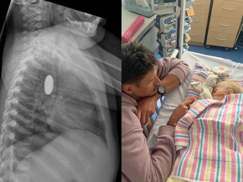 Composite image showing an x-ray and a father at his daughter's bedside in hospital.