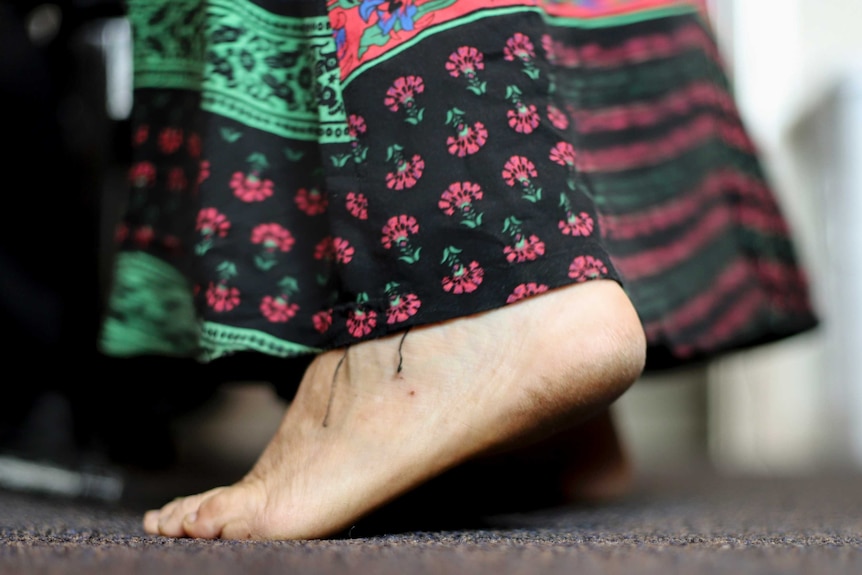 A foot arches up off a carpeted floor.