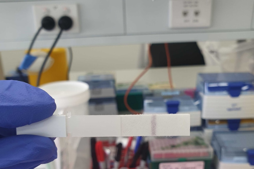 Person holding a test swab in a lab.