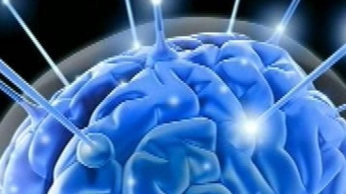 Brain scan using MRI technology