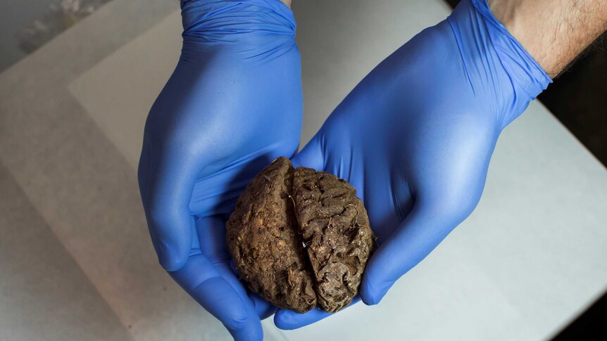Fernando Serrulla shows one of the 45 brains which were found in 2010 in a mass grave