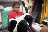 A close-up of a little girl sitting on a hospital bed with her arm bandaged and clutching a panda bear.