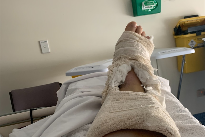 A photo of a bandaged foot raised on a hospital bed