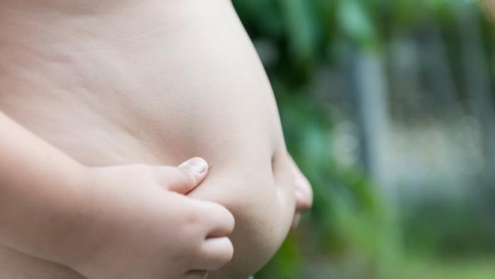 An overweight child holds his hands to his stomach