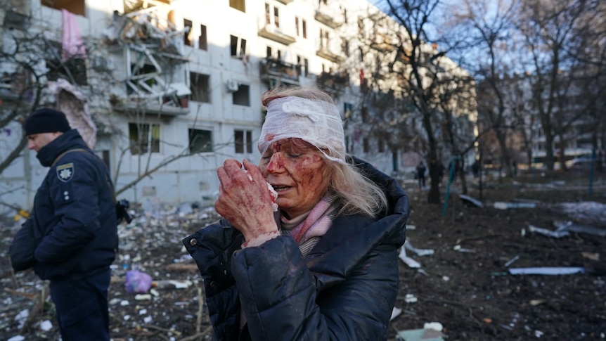 Wounded Ukrainian woman 